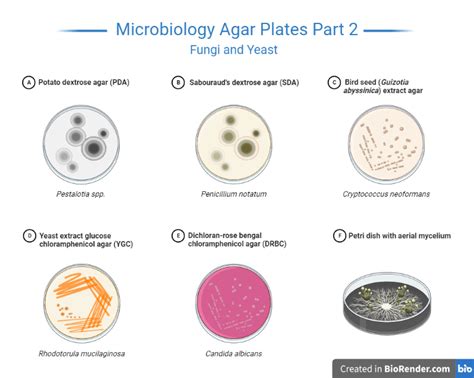 how to identify bacteria on agar plates.